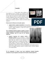 Anatomía del maxilar superior: puntos óseos radiográficos