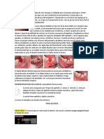 La microestructura de la encía y su importancia en el éxito de los implantes dentales
