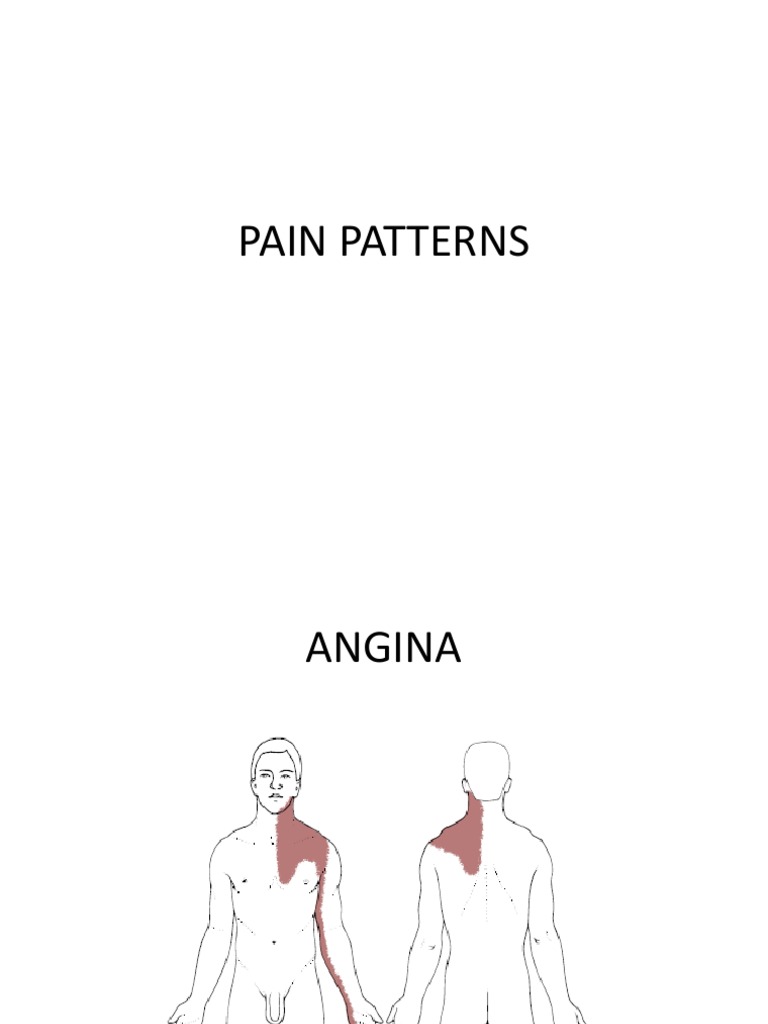 Comprehensive Guide to Pain Patterns | PDF
