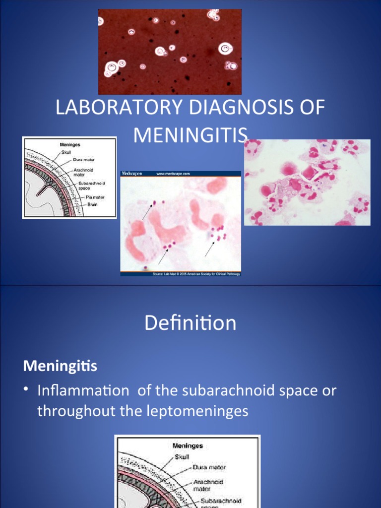 LABORATORY DIAGNOSIS OF MENINGITIS