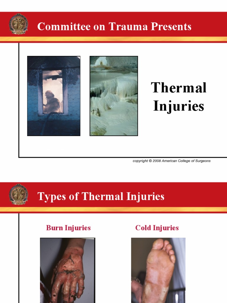 Thermal Injury PDF Hypothermia Burn