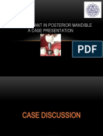 Case Presentation-Implant in Posterior Mandible