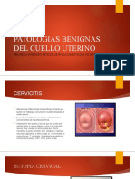 Patologia Benigna de Cuello Uetrino