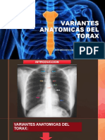 Variantes anatómicas del tórax