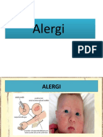 Pert. 7 Alergi