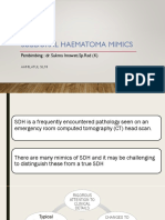 Subdural Haematoma Mimics