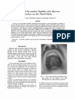 (Ban Et Al., 1995) A Case of Secondary Syphilis With Mucous Patches On The Hard Palate