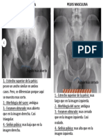 Diferencias Pelvis Fem y Masc