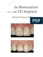 Esthetic Restoration of The ITI Implant: Richard P. Kinsel, DDS