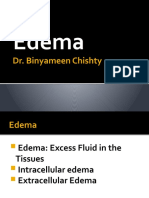 Edema: Dr. Binyameen Chishty