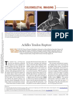 Achilles Tendon Rupture: Musculoskeletal Imaging