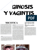 Vaginitis y Vaginosis