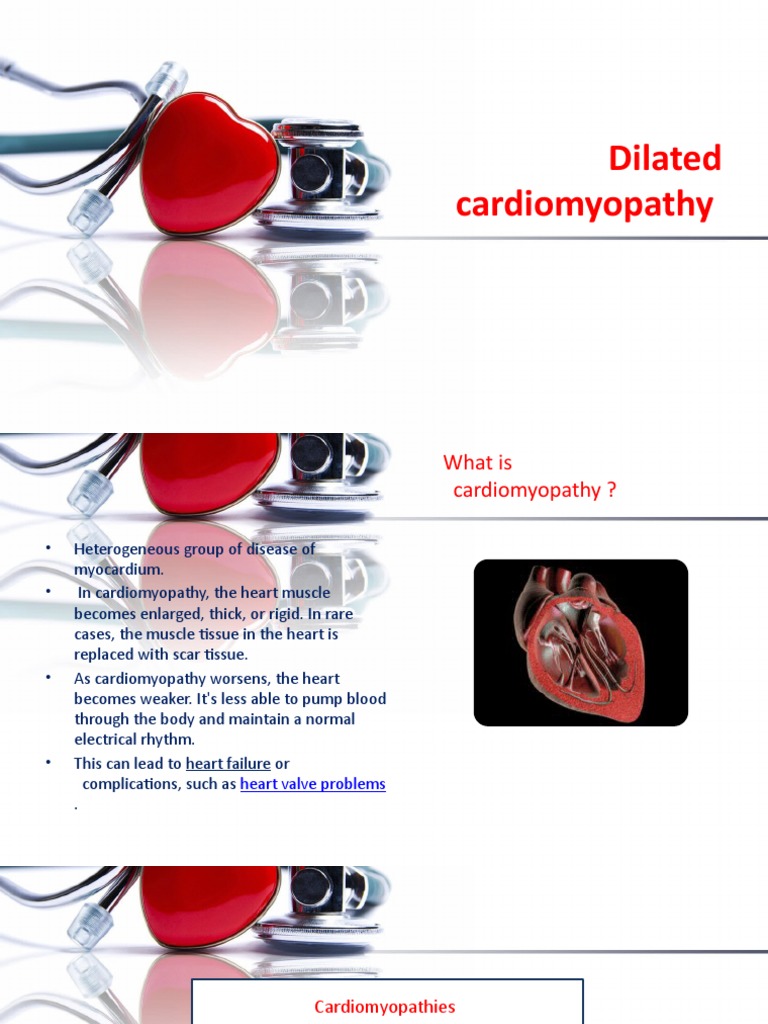 Dilated Cardiomyopathy | PDF | Heart | Internal Medicine
