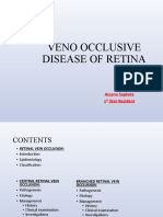 Veno Occlusive Disease of Retina