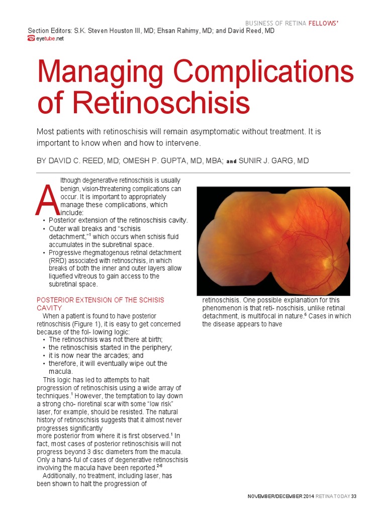 Managing Complications of Retinoschisis | PDF | Ophthalmology | Human Eye