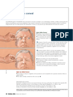 Examen Del Reflejo Corneal: Nodebehacer