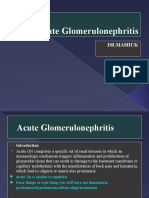 +acute Glomerulonephritis