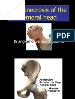 Osteonecrosis of The Femoral Head: Kriangk Benjawongsathian