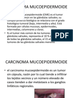 carcinomamucoepidermoide-130506190628-phpapp02