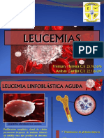 LEUCEMIAS