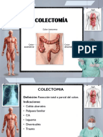 COLECTOMIA