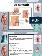 COLOSTOMIA