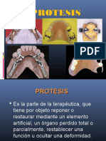 protesisparcialremovible1rasemana-140929121546-phpapp01