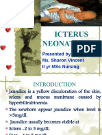 Icterus Neonatorum: Presented By: Ms. Sharon Vincent Ii Yr MSC Nursing