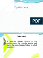 Episiotomy