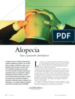 Alopecia