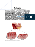 Trabajo Celiaquia 2019