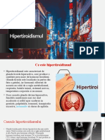 Hipertiroidism