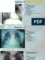 Practica Radiografia de Torax - Fernanda Burgos Balderrama