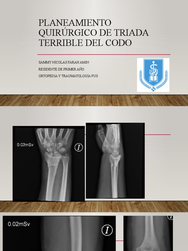 Triada Terrible, Planeamiento | PDF