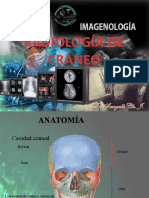 Radiologia de Craneo