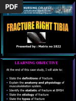 Download  rt tibia by Catherine Milkha SN51371613 doc pdf