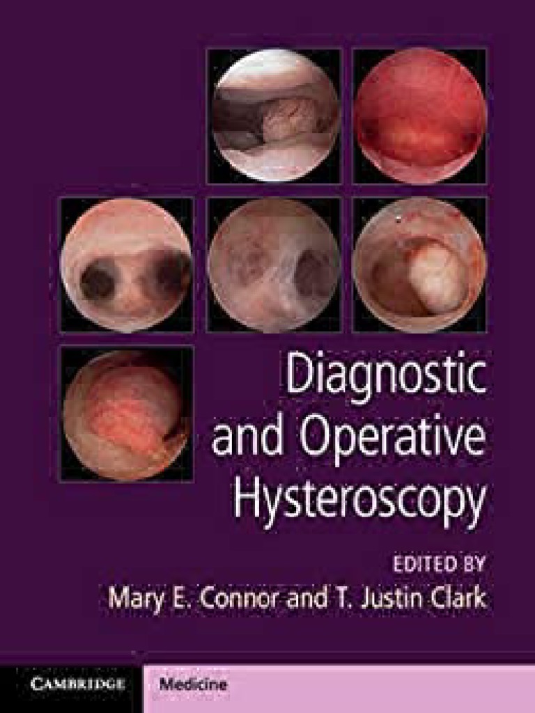 MCU 2020 Diagnostic and Operative Hysteros, PDF