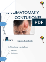 1.2. Hematomass y Contusiones