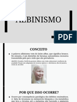 PPT - Albinismo O branco que a natureza merece. PowerPoint Presentation -  ID:5252138