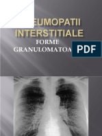 CURS 15.1-Pneumopatii Interstitiale Granulomatoase