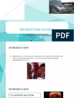 Hemoptisis Masiva