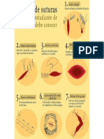 7 Tipos de Suturas