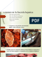 Lesiones hepáticas causadas por Fasciola hepatica