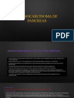 Adenocarcinoma de Pancreas
