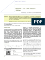 Hydrocele4