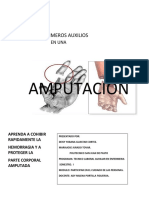 Primeros auxilios amputación