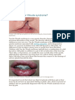 Van Der Woude Syndrome