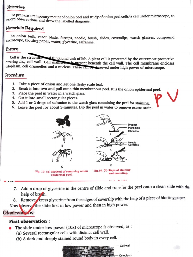 Onion Peel Cell Experiment PDF Cell Nucleus Cell (Biology)