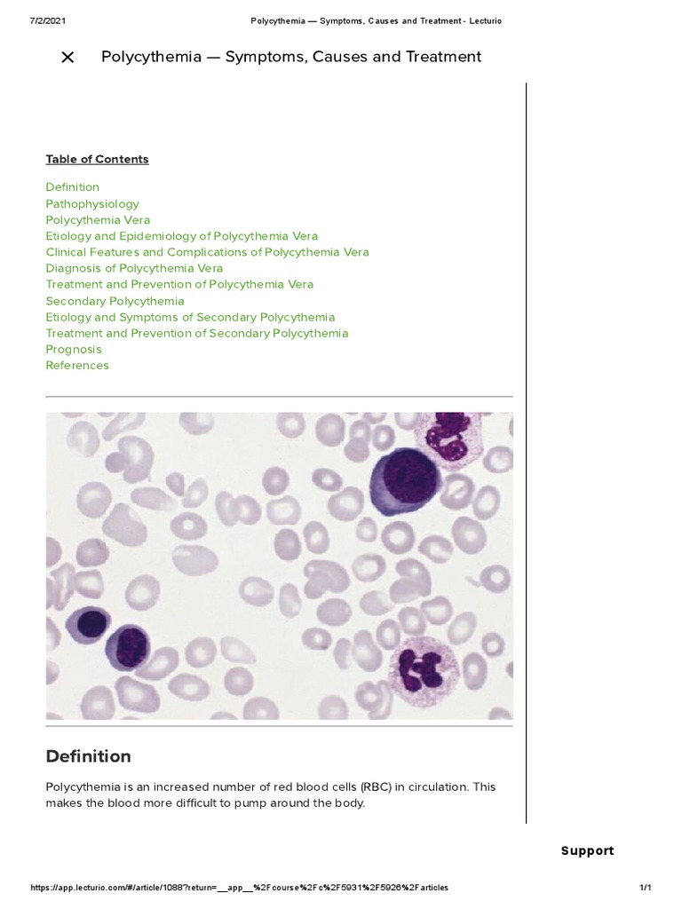 POLYCYTHEMIA CAUSES SYMPTOMS DIAGNOSIS TREATMENT intelligence overview