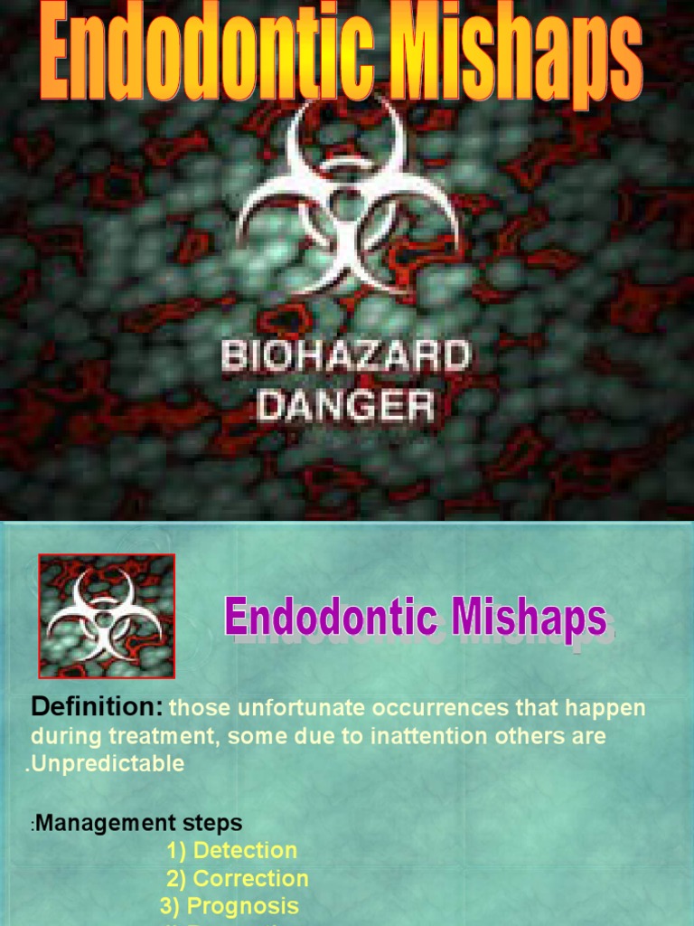 A Comprehensive Guide to Common Endodontic Mishaps Causes, Detection